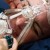 CPAP Intolerance